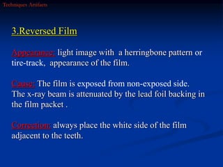 Inverted Radiographic Film radiographic errors.ppt