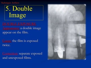 radiographic errors.ppt