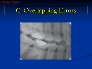 radiographic errors.ppt