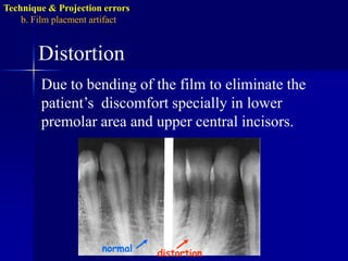 Technique & Projection errorsb. Film placmentartifactArea of interest not shownThis is the result of not placing the film to cover all the teeth in the area of interest and not centralizing the film over the area of interest.