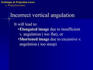 Technique & Projection errorsb. Film placmentartifactBlack lineDue to excessive bending of the film prior to its placement inside the patient’s mouth (pressure causes ionization of silver halide upon processing will be darker).