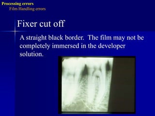 White spot or patch.