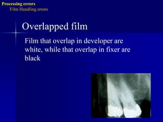 Yellowish brown discoloration.Film Handling errors:Writing lines