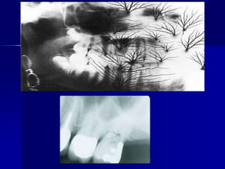 Finger nail artifact