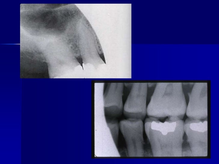 Radiographic errors and artifacts