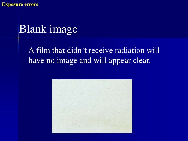 Radiographic errors and artifacts