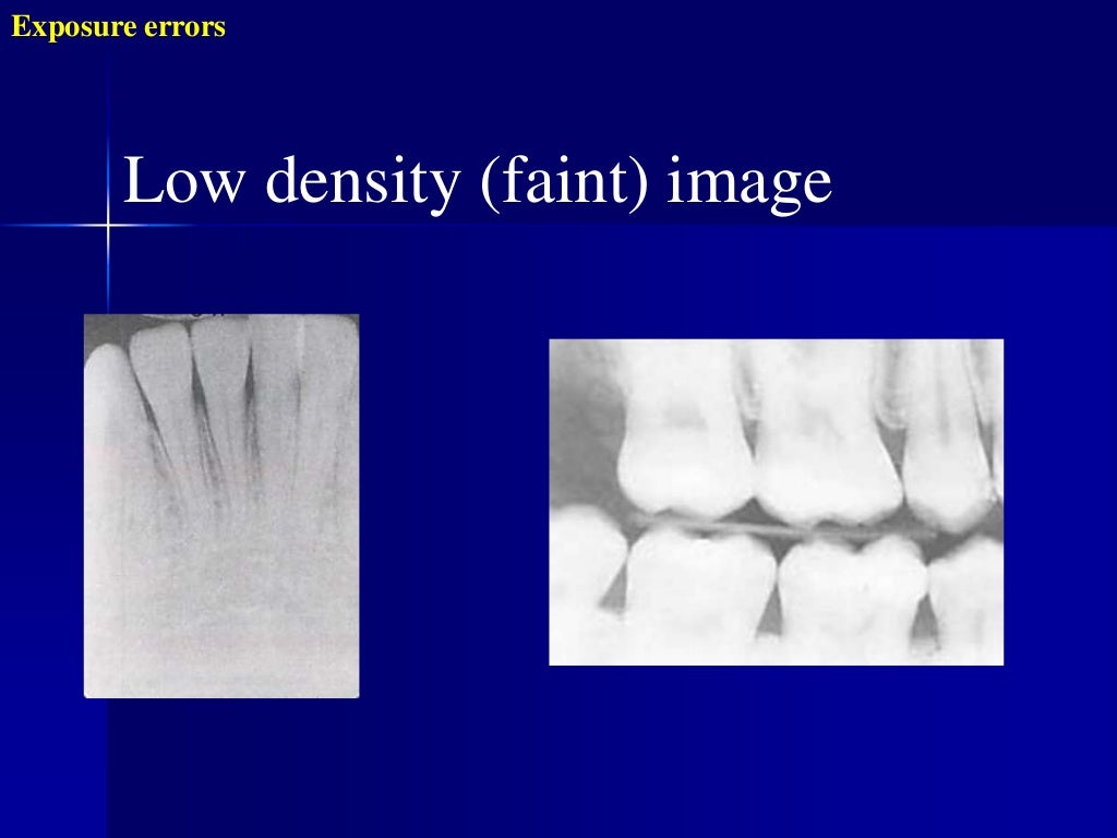 Radiographic errors and artifacts