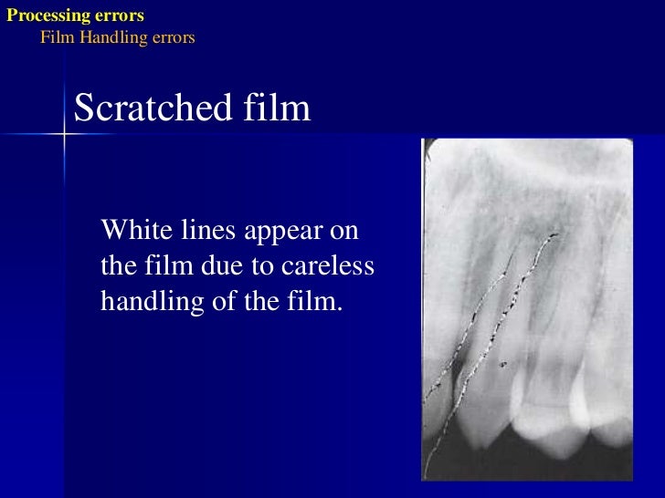 Radiographic errors and artifacts