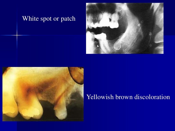 Radiographic errors and artifacts