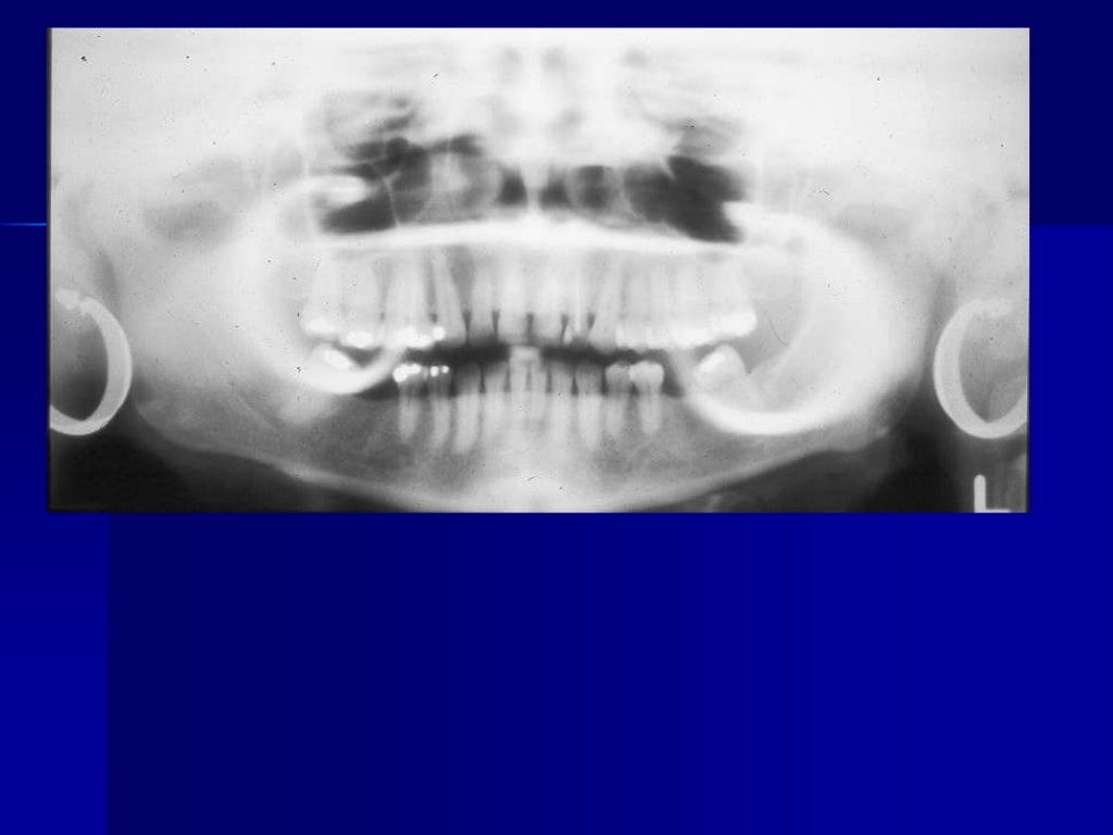 Radiographic errors and artifacts