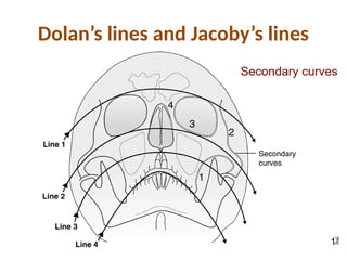 RADIOGRAPHIC EVALUATION IN ORAL AND MAXILLOFACIALTRAUMA | PPTX