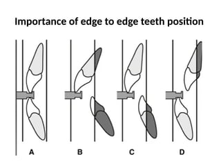 RADIOGRAPHIC EVALUATION IN ORAL AND MAXILLOFACIALTRAUMA | PPTX