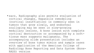 RADIOGRAPHIC EVALUATION OF BONE TUMORS visual data 7