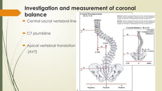 Radiographic evaluation of scoliosis.pptx