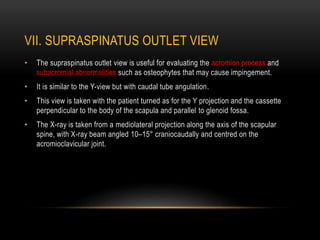 VII. SUPRASPINATUS OUTLET VIEW
• The supraspinatus outlet view is useful for evaluating the acromion process and
subacromi...