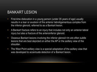BANKART LESION
• First-time dislocation in a young person (under 35 years of age) usually
results in a tear or avulsion of...