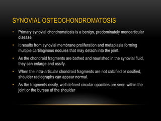 SYNOVIAL OSTEOCHONDROMATOSIS
• Primary synovial chondromatosis is a benign, predominately monoarticular
disease.
• It resu...