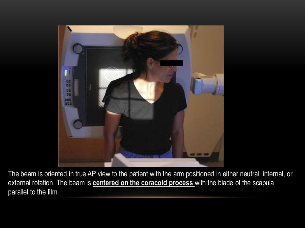 Radiographic evaluation of shoulder