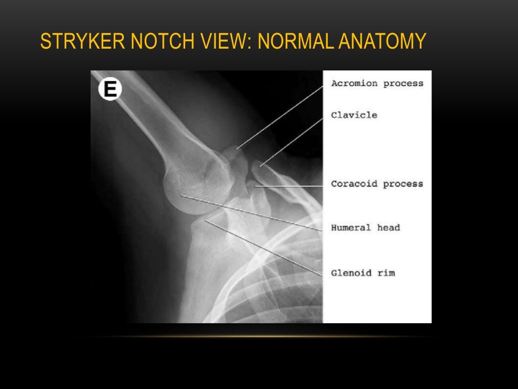 Radiographic evaluation of shoulder