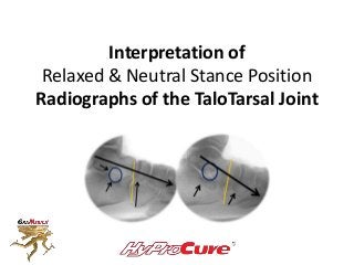 Interpretation of
Relaxed & Neutral Stance Position
Radiographs of the TaloTarsal Joint
 