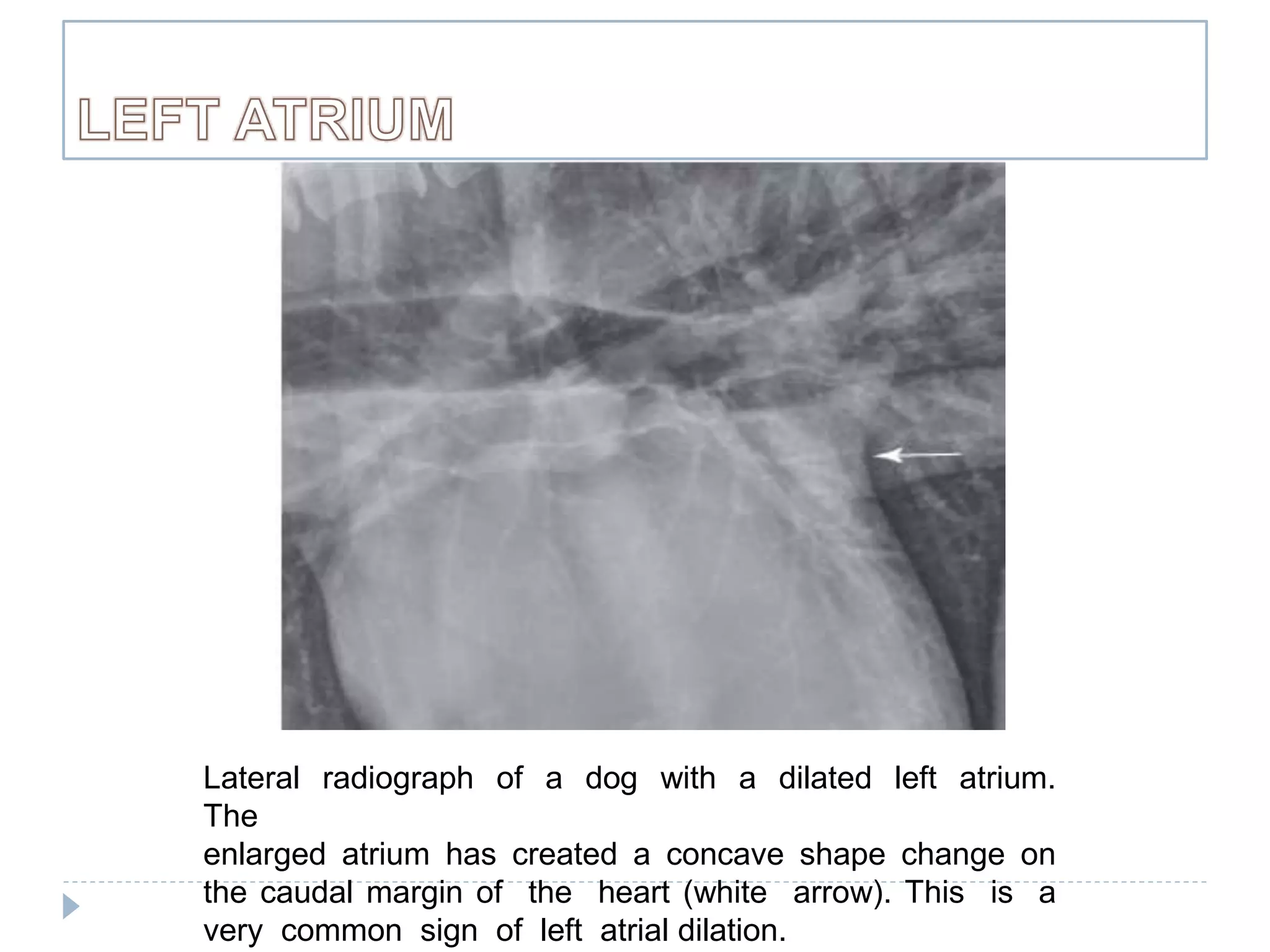 Radiographic Examination of Cardiovascular System | PPTX