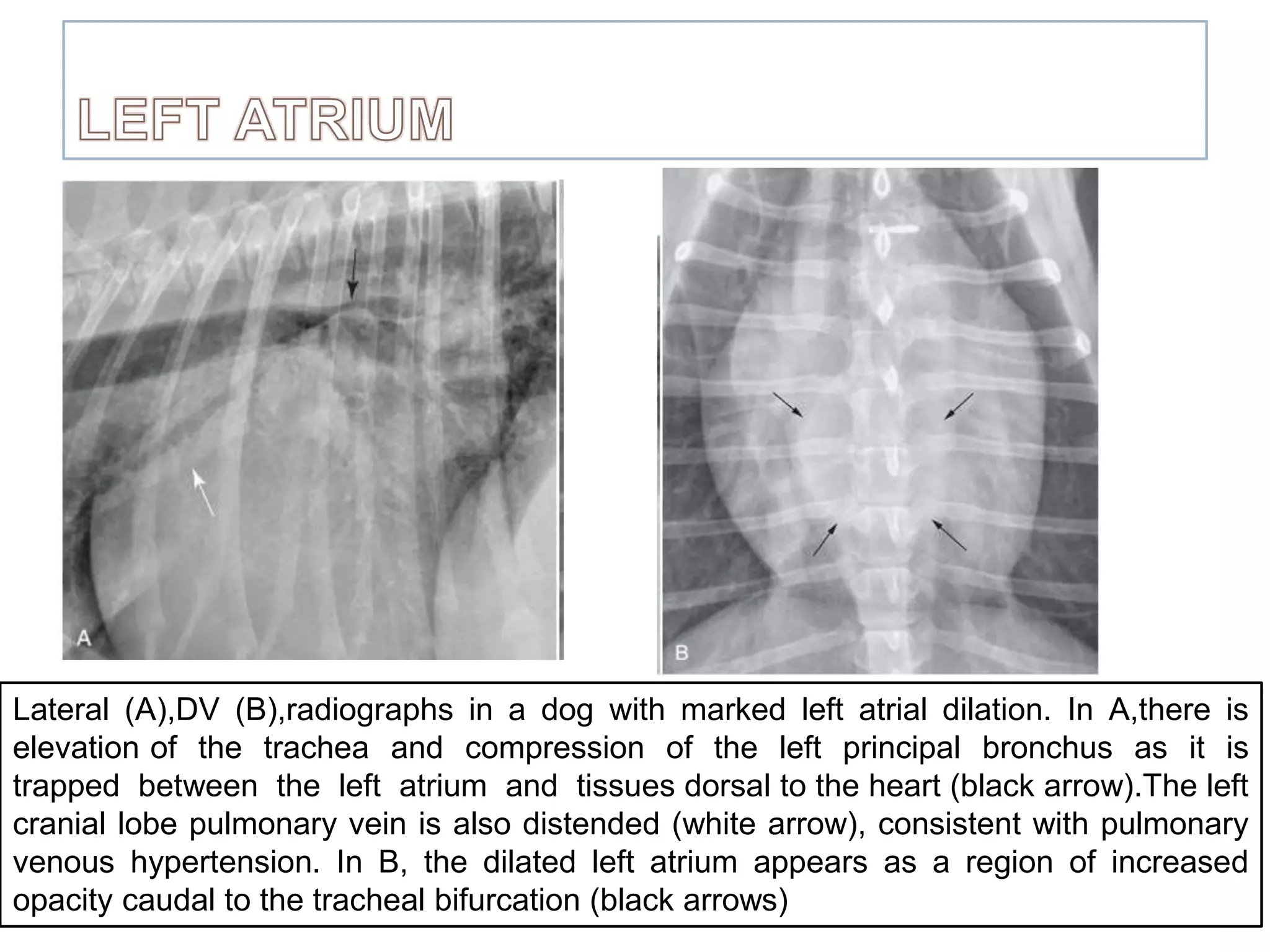 Radiographic Examination of Cardiovascular System | PPTX