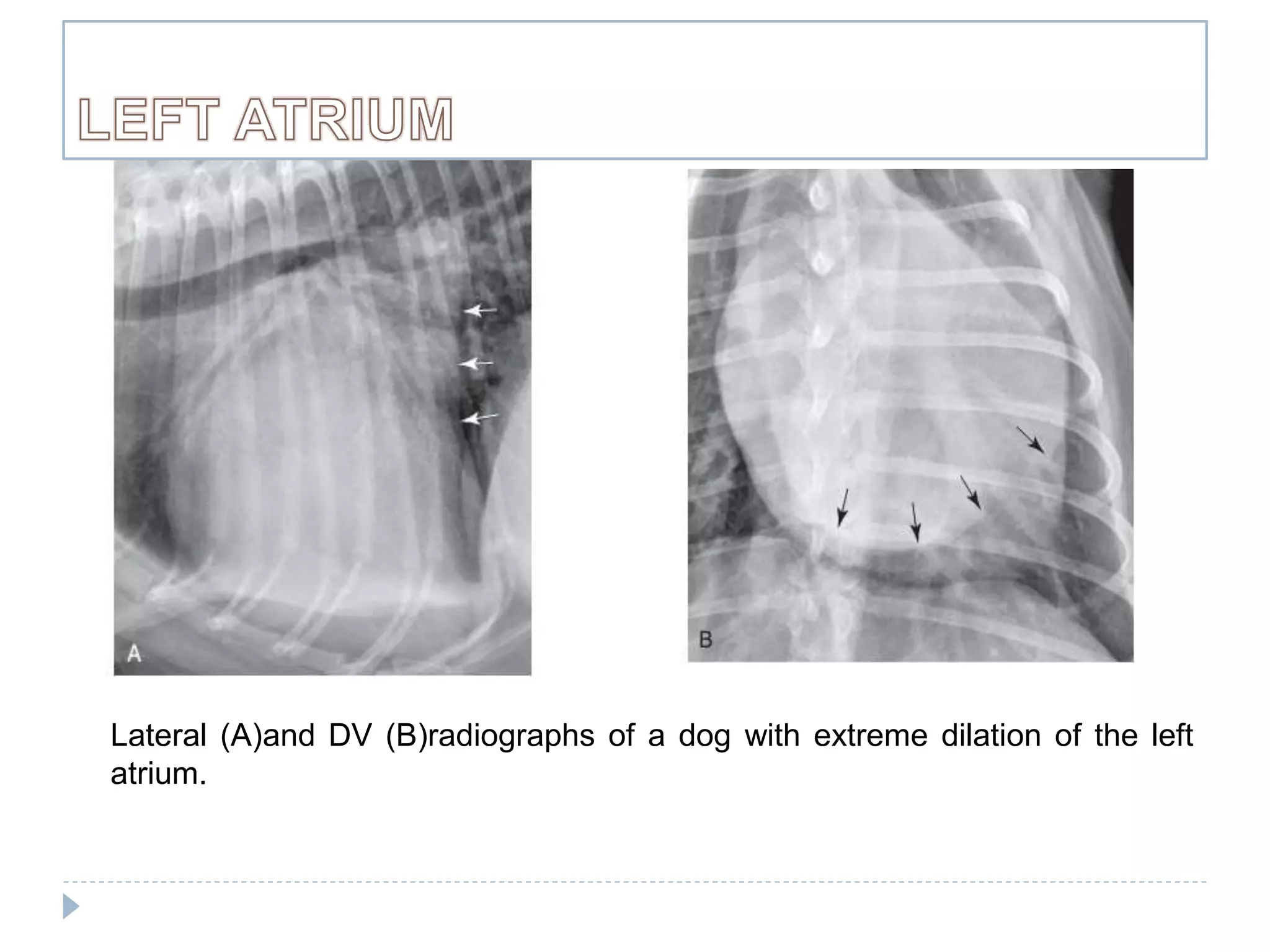 Radiographic Examination of Cardiovascular System | PPTX