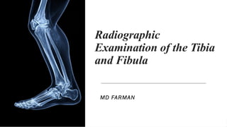 Radiographic Examination of the Tibia and Fibula.pptx