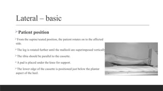 Radiographic Examination of the Tibia and Fibula.pptx