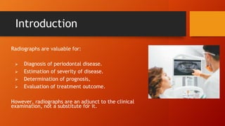 RADIOGRAPHIC EXAMINATIONS OF BONE LOSS AND PATTERN OF BONE LOSS | PPTX