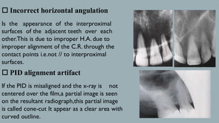 Undercut Radiograph RADIOGRAPHIC FAULTS and Artifacts bds (omdr) | PDF
