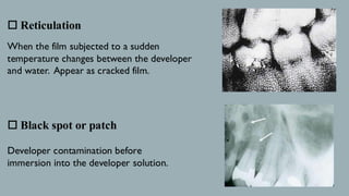 Film Developing Reticulation RADIOGRAPHIC FAULTS and Artifacts bds (omdr) | PDF