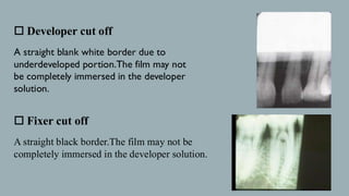Developer Cut Off RADIOGRAPHIC FAULTS and Artifacts bds (omdr) | PDF
