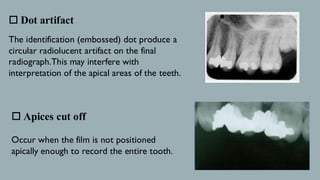 Undercut Radiograph RADIOGRAPHIC FAULTS and Artifacts bds (omdr) | PDF