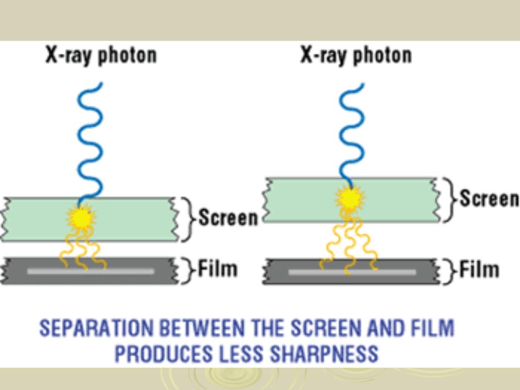Radiographic film ; intensifying screens