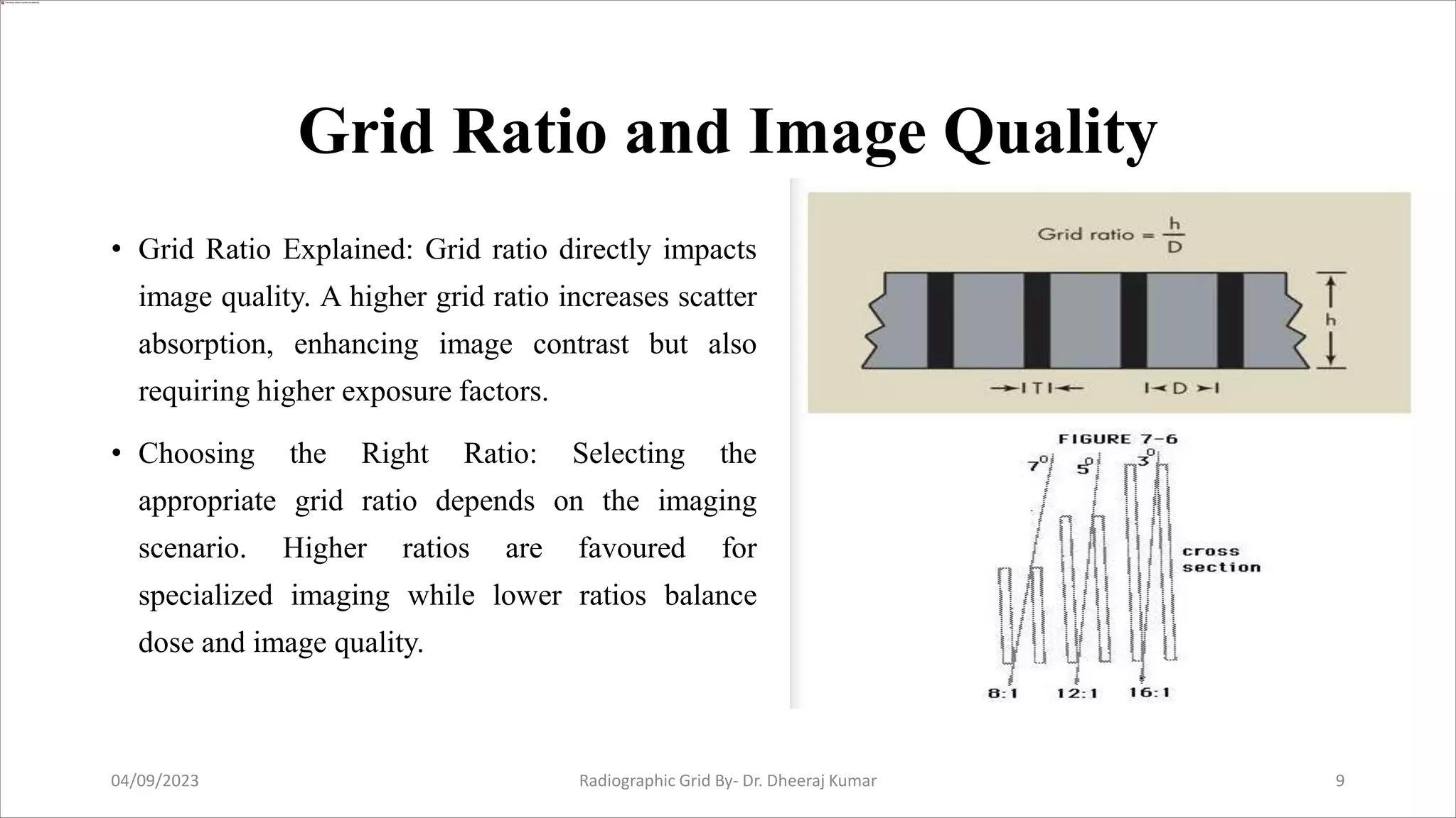Radiographic Grid.pptx