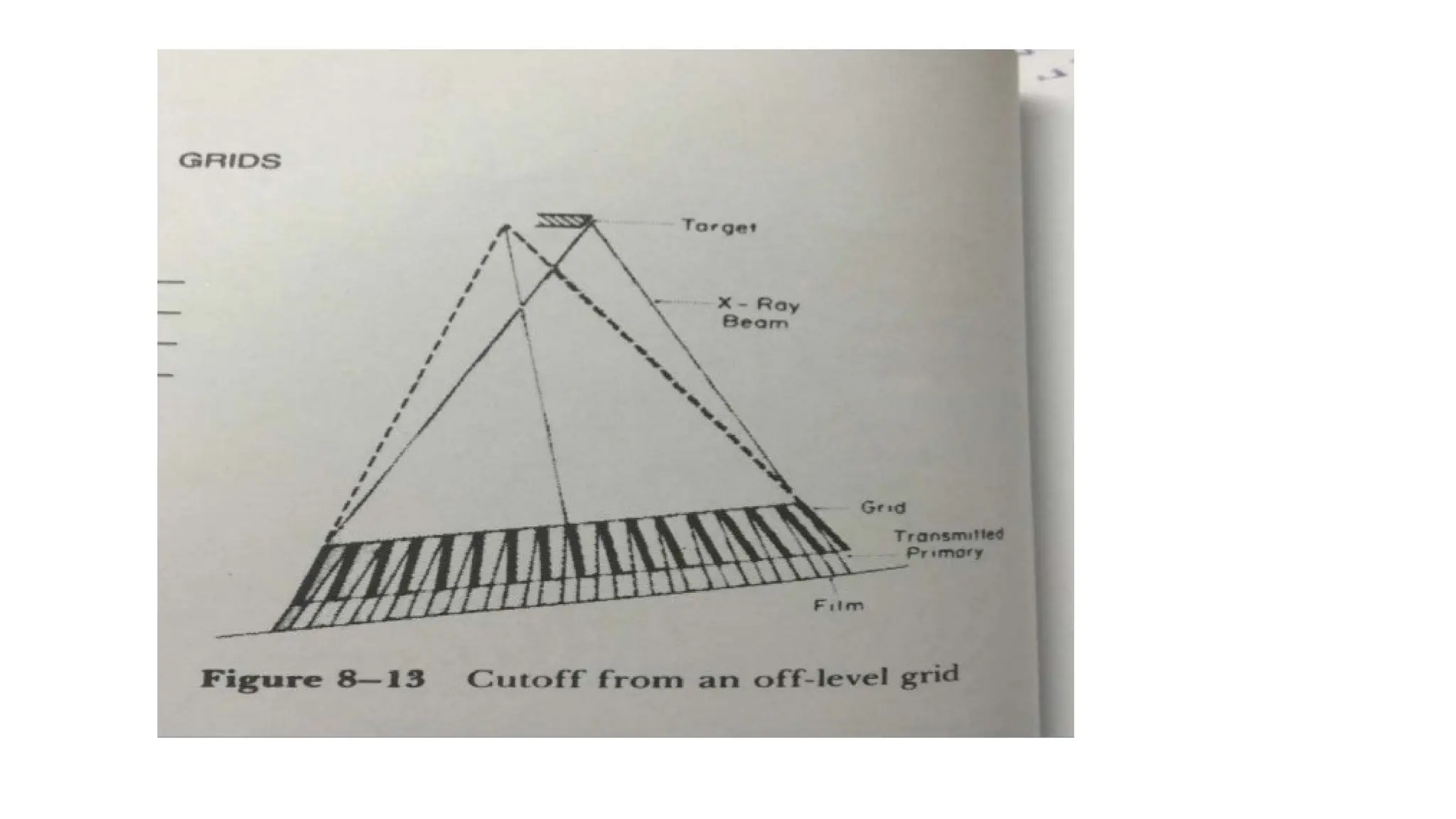 Radiographic grid uses and its types .pptx