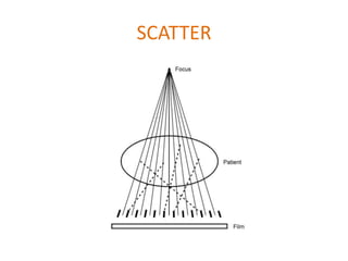 Radiographic grids | PPTX