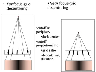 • Far focus-grid
decentering
•Near focus-grid
decentering
•cutoff at
periphery
•dark center
•cutoff
proportional to
•grid ...