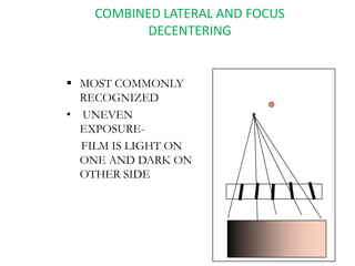 COMBINED LATERAL AND FOCUS
DECENTERING
 MOST COMMONLY
RECOGNIZED
• UNEVEN
EXPOSURE-
FILM IS LIGHT ON
ONE AND DARK ON
OTHE...