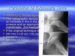 Reduction of Exposure Time
2- Intensifying Screen Speeds:
 The radiographic density can be maintained with
an increase in the in the speed of intensifying
screens and an appropriate reduction in the
overall mAs . For example:
A demonstrates quantum mottle B demonstrates recorded details .
 If the original technique required 100 mAs:




400 mAs x 0.25 sec =100 mAs
Change to:
400 mAs x 0.125 sec = 50mAs with high speed screen.

 