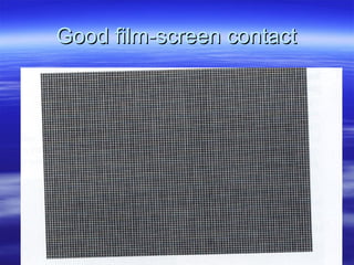 Good film-screen contact

 