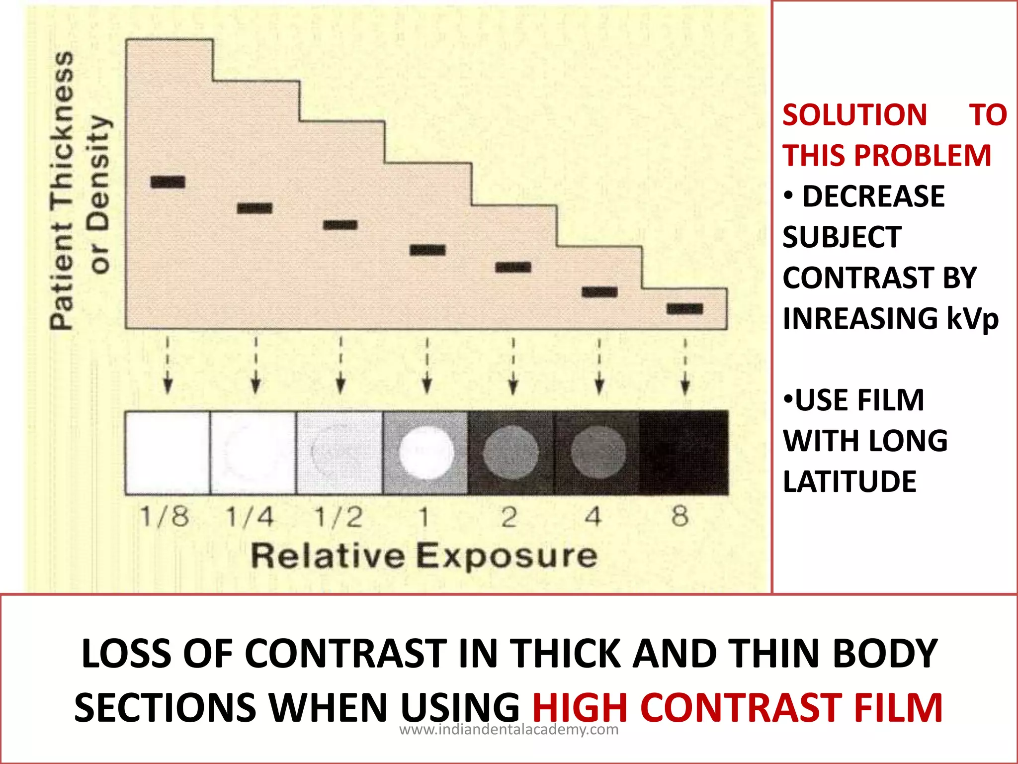 SOLUTION TO
THIS PROBLEM
• DECREASE
SUBJECT
CONTRAST BY
INREASING kVp
•USE FILM
WITH LONG
LATITUDE
LOSS OF CONTRAST IN THICK AND THIN BODY
SECTIONS WHEN USING HIGH CONTRAST FILMwww.indiandentalacademy.com
 