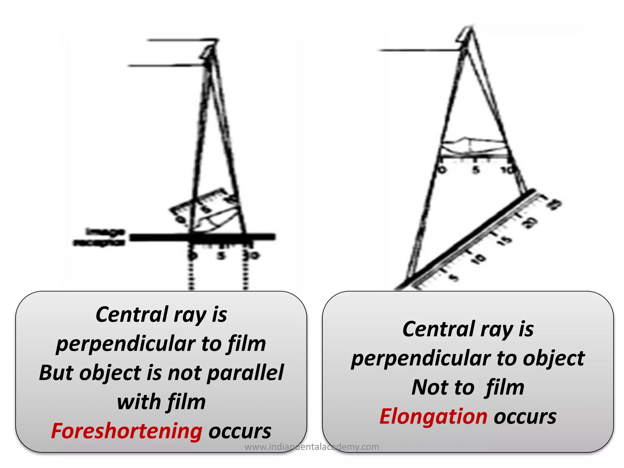 Central ray is
perpendicular to film
But object is not parallel
with film
Foreshortening occurs
Central ray is
perpendicular to object
Not to film
Elongation occurs
www.indiandentalacademy.com
 