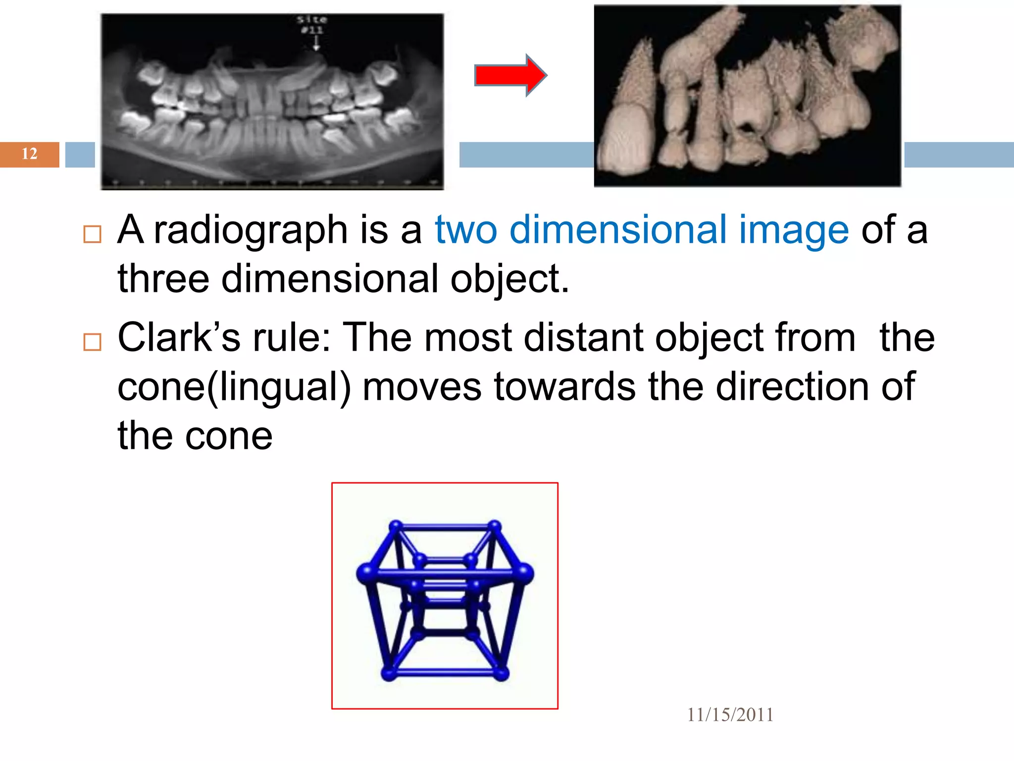 12



        A radiograph is a two dimensional image of a
         three dimensional object.
        Clark’s rule: The most distant object from the
         cone(lingual) moves towards the direction of
         the cone




                                        11/15/2011
 