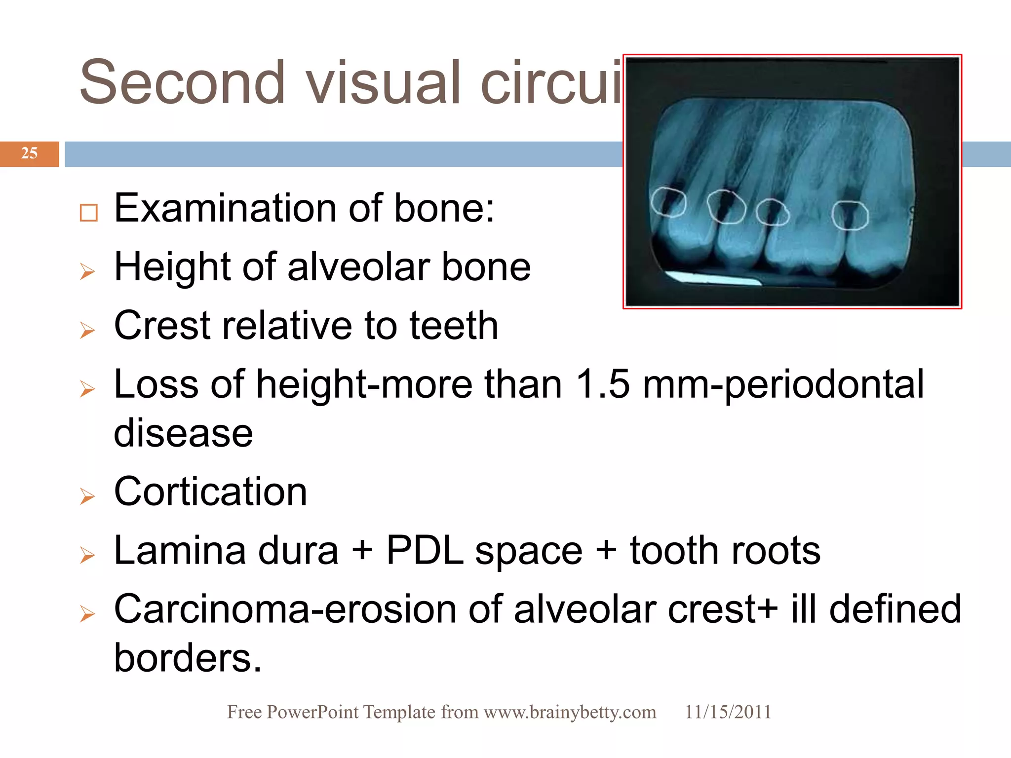 Second visual circuit
25


        Examination of bone:
        Height of alveolar bone
        Crest relative to teeth
        Loss of height-more than 1.5 mm-periodontal
         disease
        Cortication
        Lamina dura + PDL space + tooth roots
        Carcinoma-erosion of alveolar crest+ ill defined
         borders.
               Free PowerPoint Template from www.brainybetty.com   11/15/2011
 