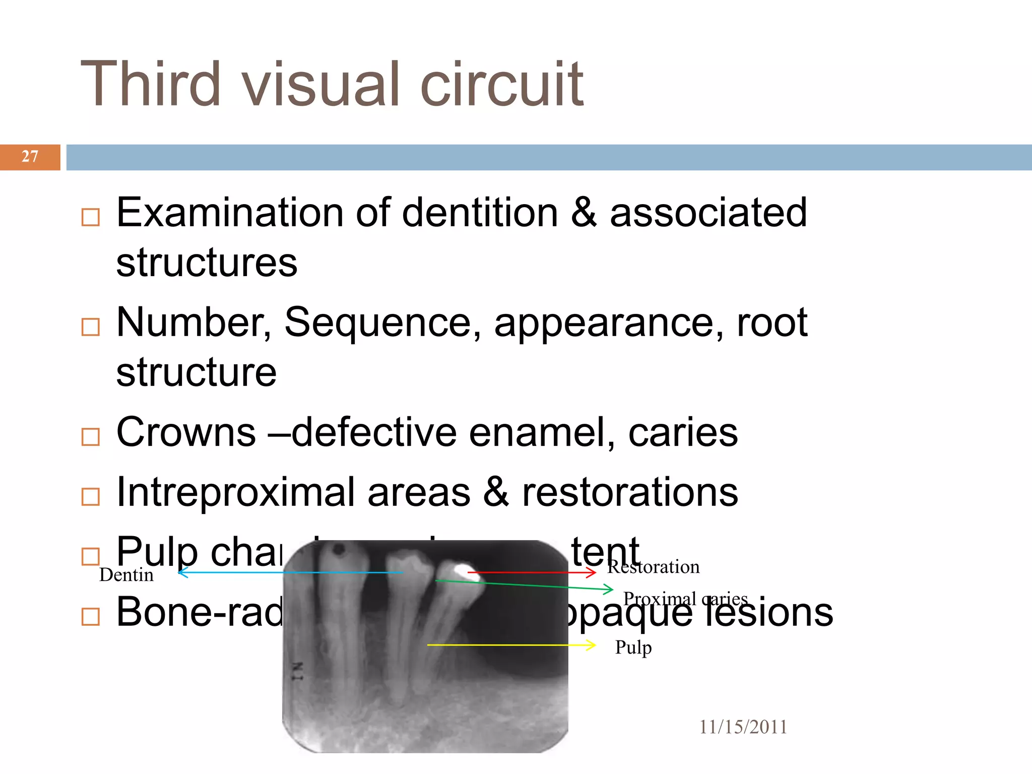 Third visual circuit
27


      Examination of dentition & associated
       structures
      Number, Sequence, appearance, root

       structure
      Crowns –defective enamel, caries

      Intreproximal areas & restorations

      Pulp chambers-size, contentRestoration
      Dentin
                                   Proximal caries
      Bone-radioluscent/radioopaque lesions
                                    Pulp


                                           11/15/2011
 