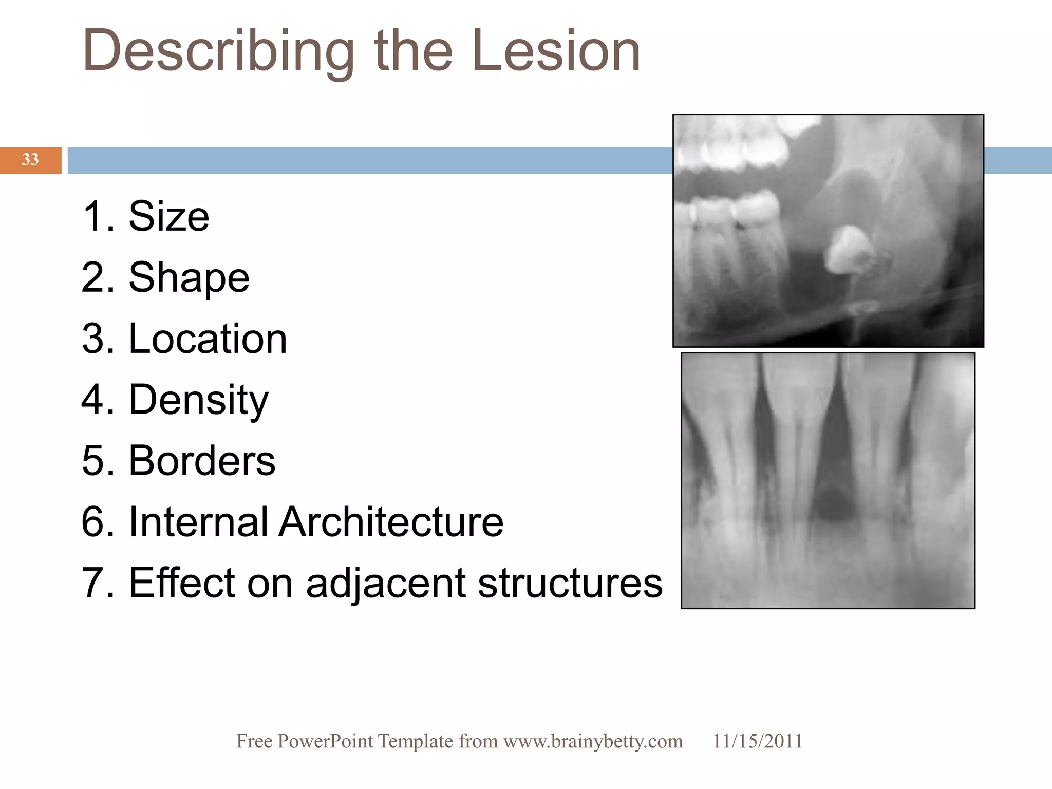 Describing the Lesion
33


     1. Size
     2. Shape
     3. Location
     4. Density
     5. Borders
     6. Internal Architecture
     7. Effect on adjacent structures


             Free PowerPoint Template from www.brainybetty.com   11/15/2011
 