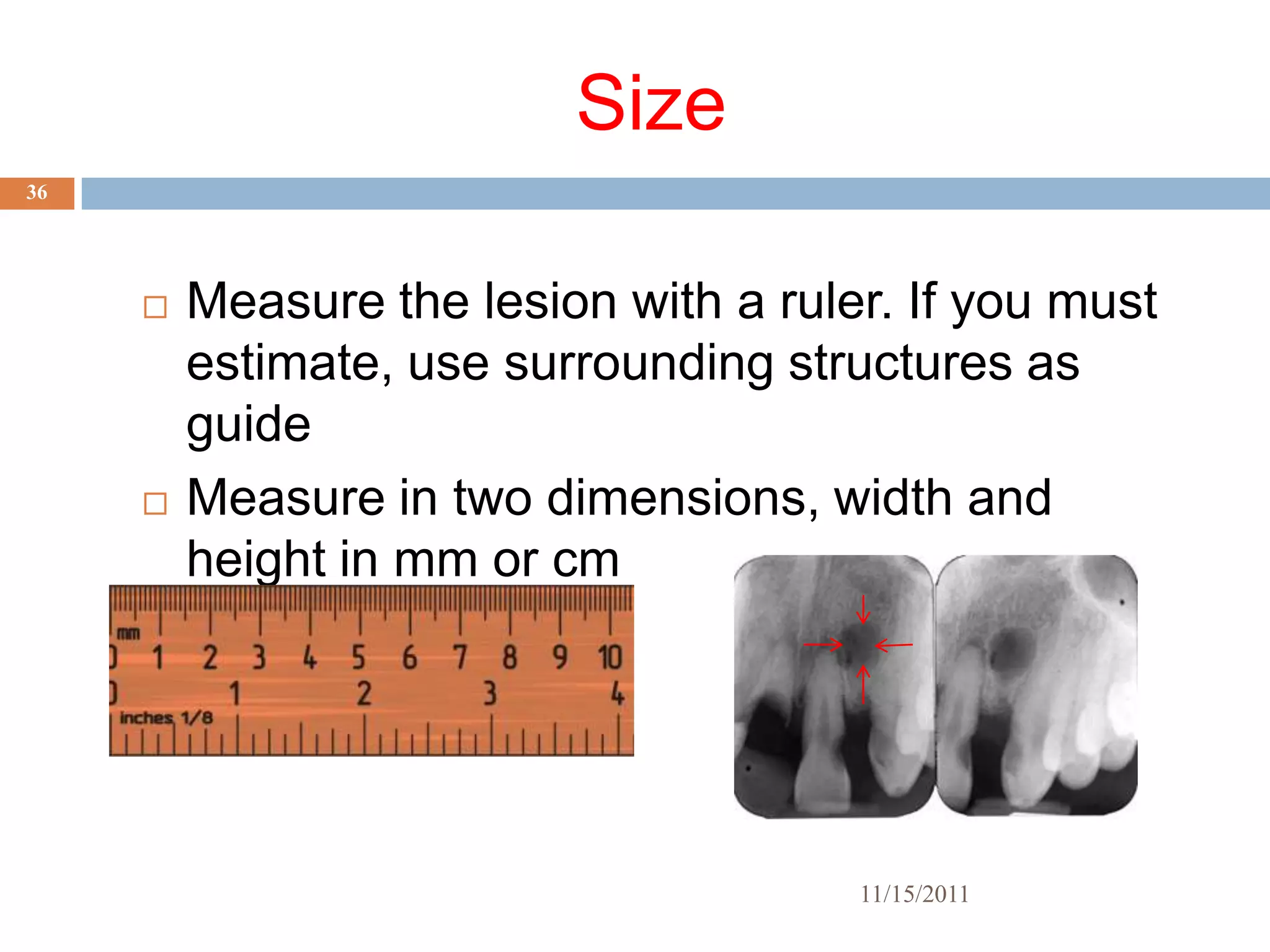 Size
36




        Measure the lesion with a ruler. If you must
         estimate, use surrounding structures as
         guide
        Measure in two dimensions, width and
         height in mm or cm




                                       11/15/2011
 