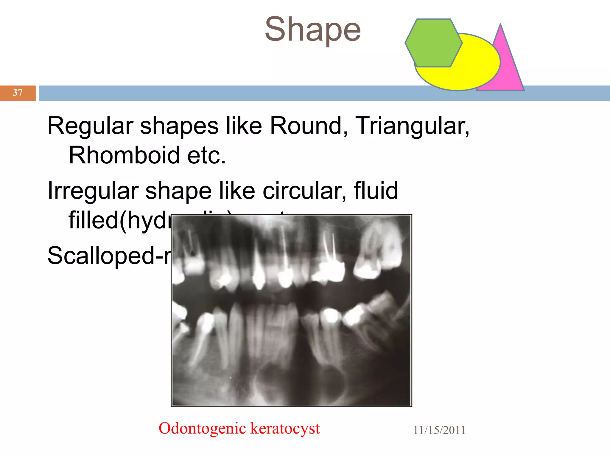 Shape
37


     Regular shapes like Round, Triangular,
        Rhomboid etc.
     Irregular shape like circular, fluid
        filled(hydraulic)-cyst
     Scalloped-multilocular app.




               Odontogenic keratocyst   11/15/2011
 